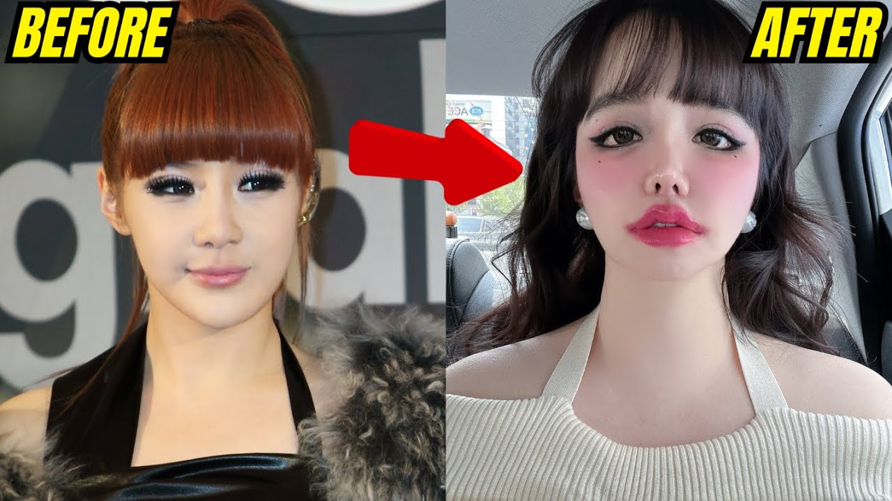 Korean Celebs Who Wanted To Look Perfect‼️ But Surgery Changed Everything!