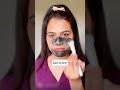Most Powerful Remedy for Blackheads/Whiteheads| Get rid of Open pores| #shorts Beautifulyoutips