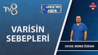 Varisin Sebepleri Nelerdir? | Op. Dr. Berke Özkan | 8'de Sağlık