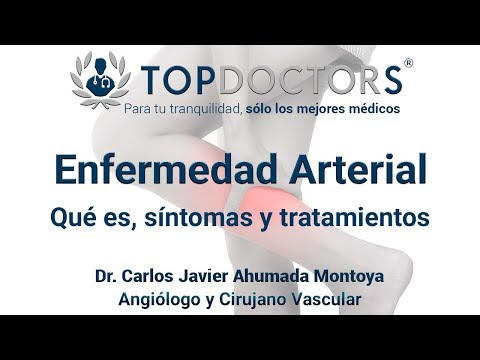 Enfermedad arterial ¿Conocer los riesgos de no tratarla a tiempo?