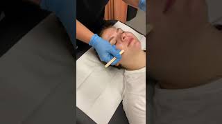 Upper Lip Demo, Hard and soft wax. Facial hair removal.