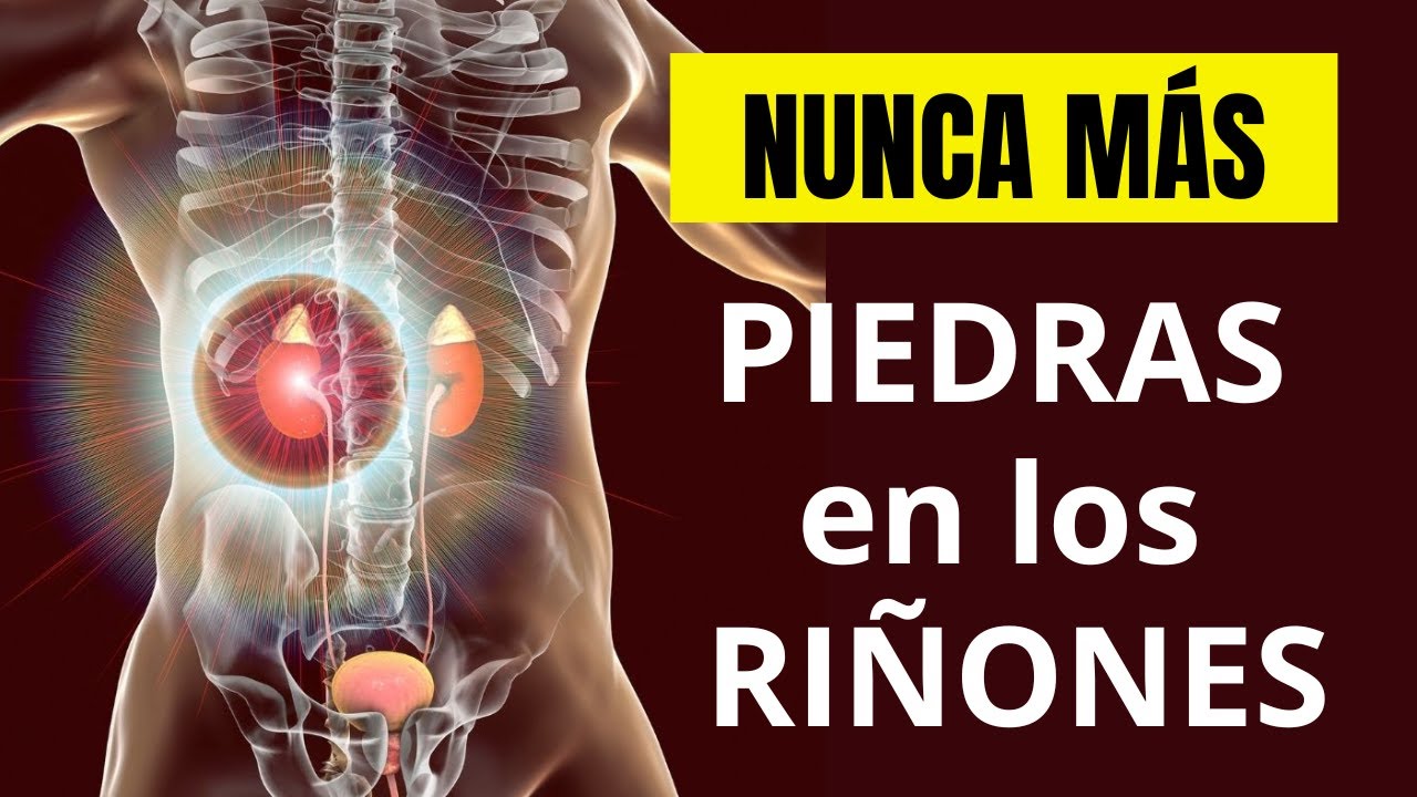 Cómo ELIMINAR las PIEDRAS EN LOS RIÑONES de manera natural - YouTube