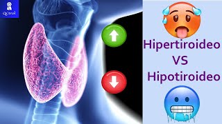 Signos y síntomas del hipotiroidismo vs hipertiroidismo