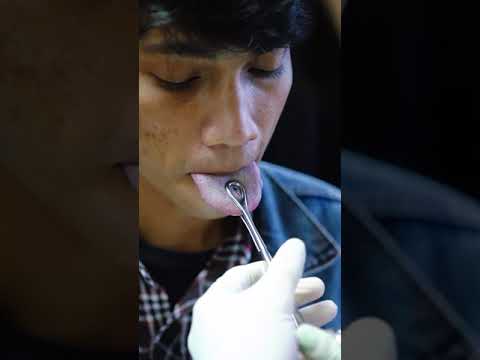 Video: Apakah tindik lidah sakit?