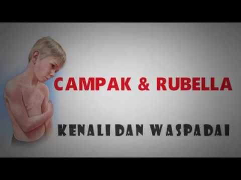 What Sakit Sendi Demam Campak