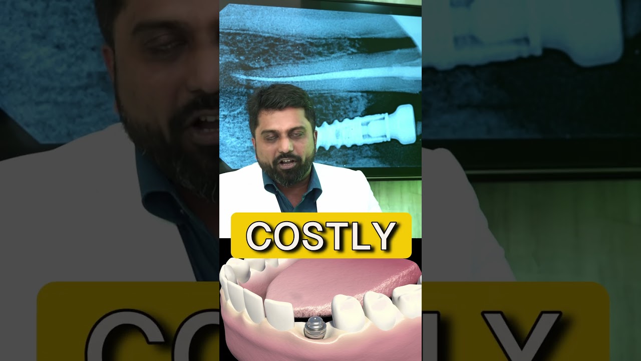 ARE Dental IMPLANTS COSTLY ? | Dr Prem Alex Lawrence in Tamil