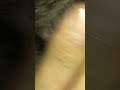 #ing #beard #hairissue #blackheadcaique #satisfying #hairproblem #howtocutcurlyhair #hair