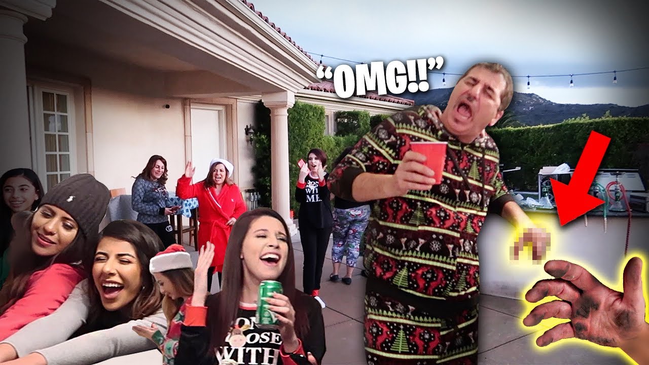 He CRASHED the Christmas Party & Then This Happened To His Hand...