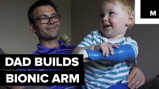 Meet The Dad Who Built a Prosthetic Arm for His Son