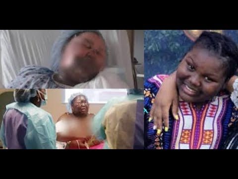 Girl's Face BURNED By Boiling Water In "HOT WATER CHALLENGE" | What's Trending Now!