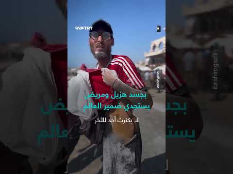 استجداء ضمير العالم لجسد هزيل ومريض