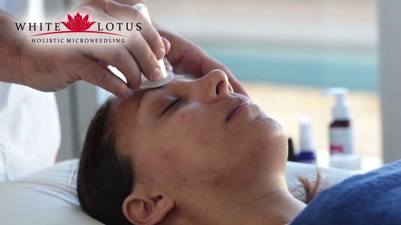 Cupping visage Clearance