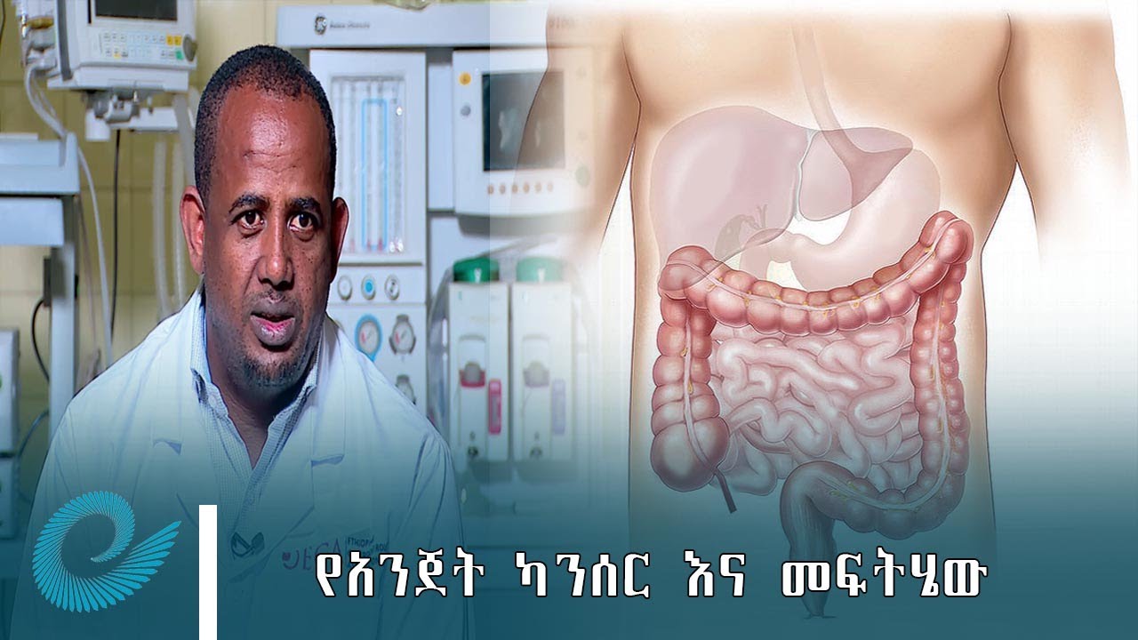 የአንጀት ካንሰር እና መፍትሄው