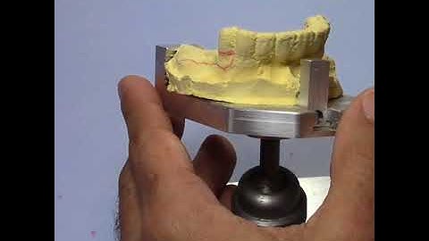 TCS Quick Tip 8 - Dealing With Difficult Cases Part 2