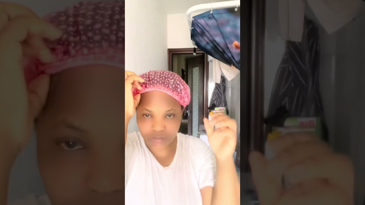 how to treat dandruff