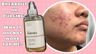 The Ordinary Glycolic Acid 7% Toning Solution Review