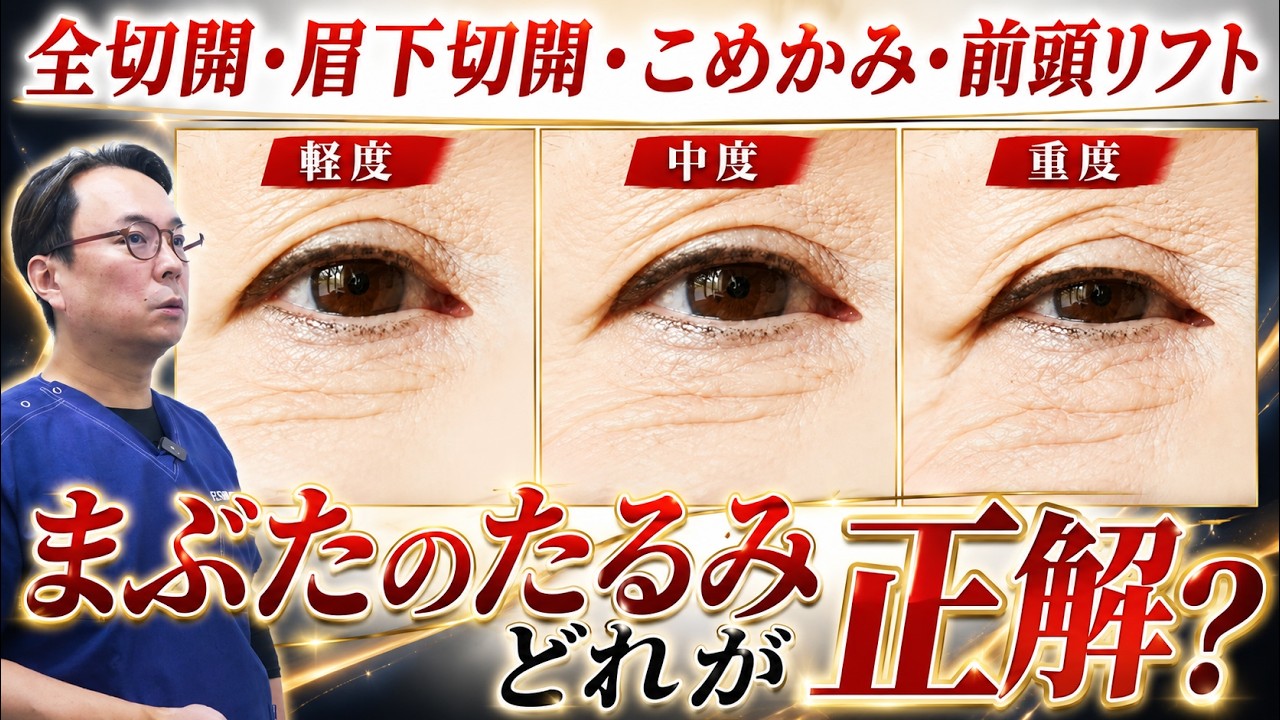 What Is the Best Treatment for Eyelid Sagging? A Thorough