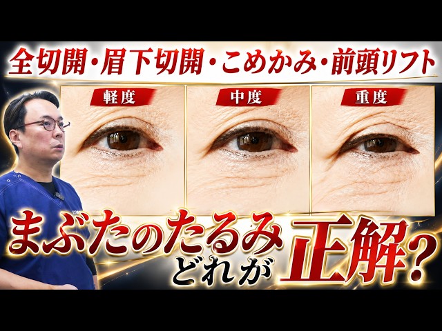What Is the Best Treatment for Eyelid Sagging? A Thorough