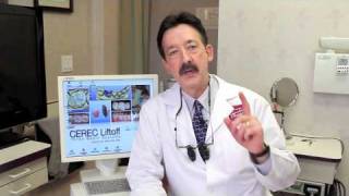 CEREC Liftoff Bluecam Introduction screenshot 2