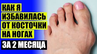 БОЛИТ КОСТОЧКА НА НОГЕ СБОКУ С ВНЕШНЕЙ СТОРОНЫ 🤧
