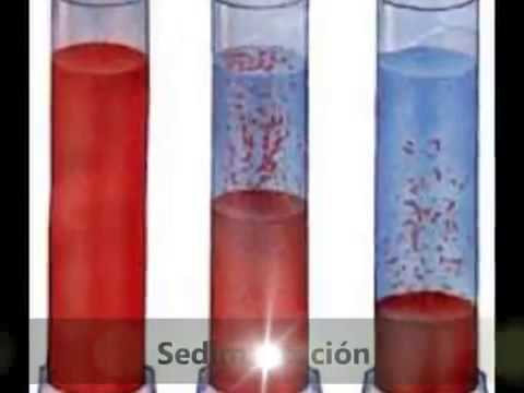 Suspensiones quimica