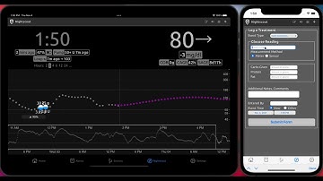Loop Follow Tutorial 6: Nightscout Tab