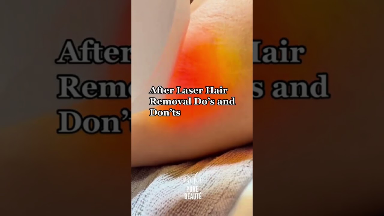 Achieve flawles, hair-free skin with advanced laser hair removal technology