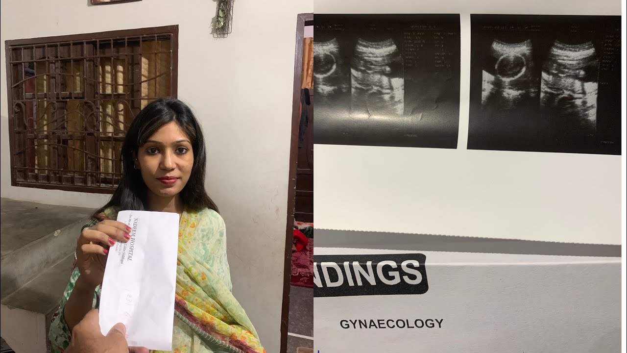 ultrasound Report |How to know baby boy or girl ultrasound report ...