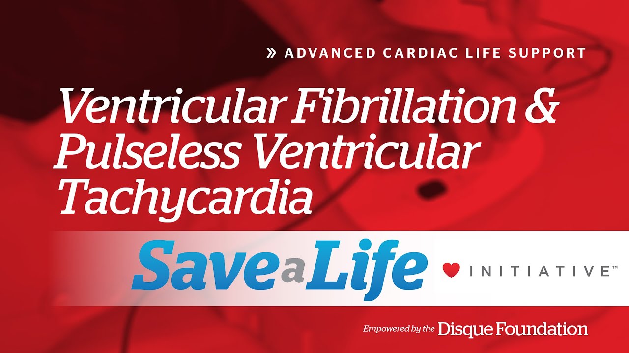 Ventricular Fibrillation And Pulseless Ventricular Tachycardia Guide