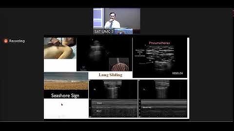 Cập nhật kiến thức và kỹ năng xử trí các bệnh lý cấp cứu thường gặp phần 3