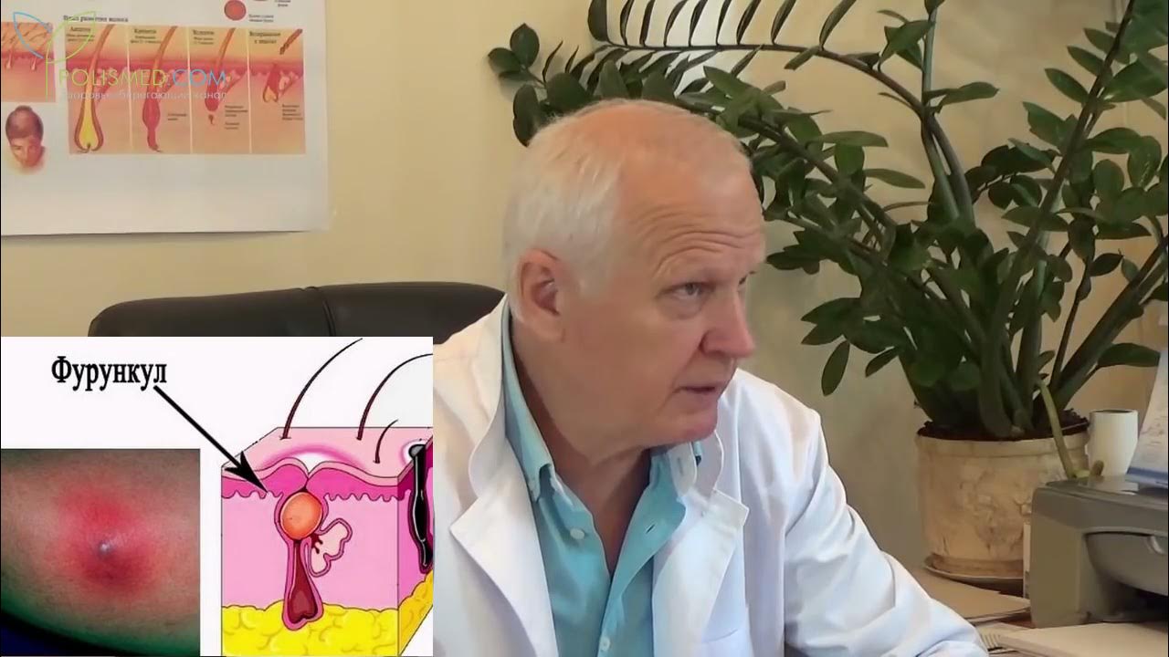Народные средства от фурункулеза. Лечение фурункулеза народными. Лечение фурункулеза народными. Лечение фурункулеза народными. Лечение фурункулеза народными.