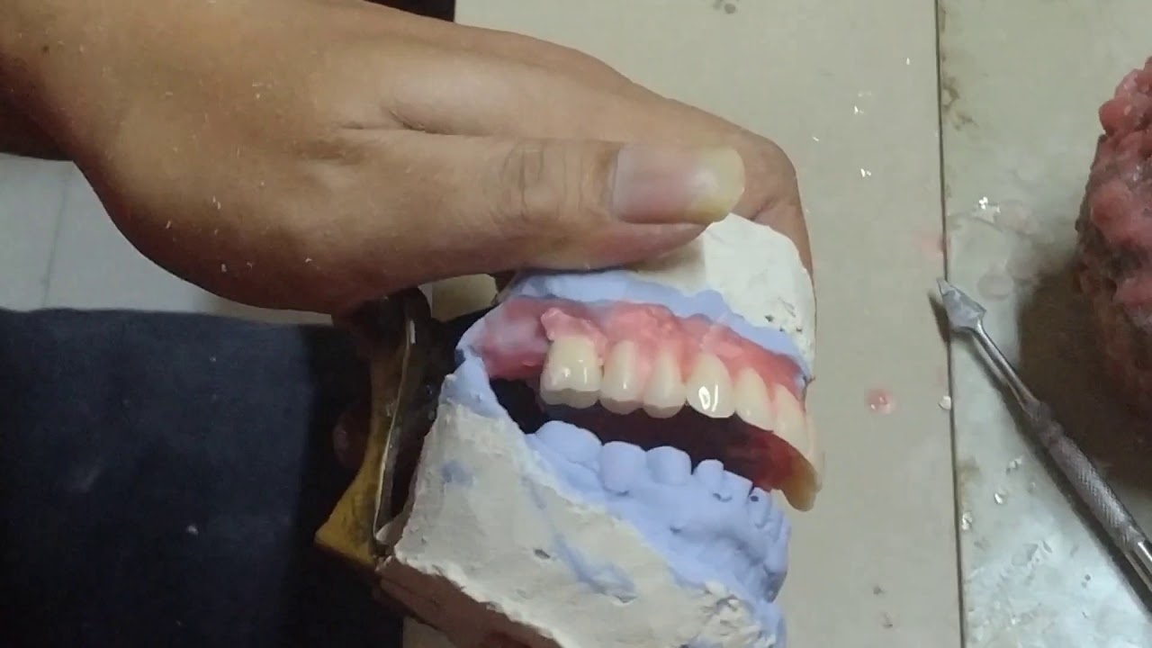 Tehnik penyusunan GIGIPALSU #1