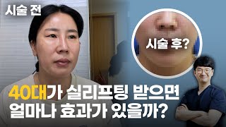 40대 실리프팅, 상담부터 다 공개합니다 (Before & After)