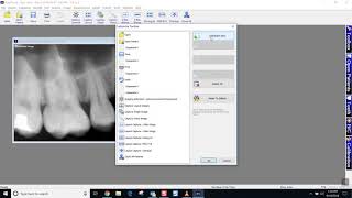 Training: Apteryx XrayVision 4: Exporting Images