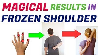 Sujok Therapy Points For Frozen Shoulder/Frozen Shoulder Sujok Treatment/Sujok For Frozen Shoulder