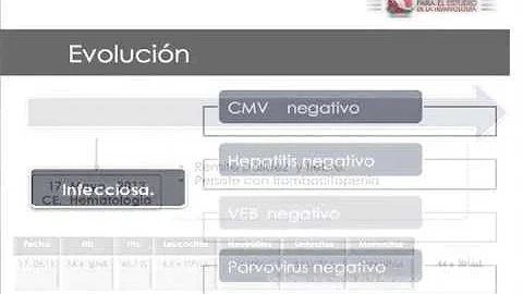 Sesin Acadmica OCT 2013 "Leucemia Megacarioblastic...