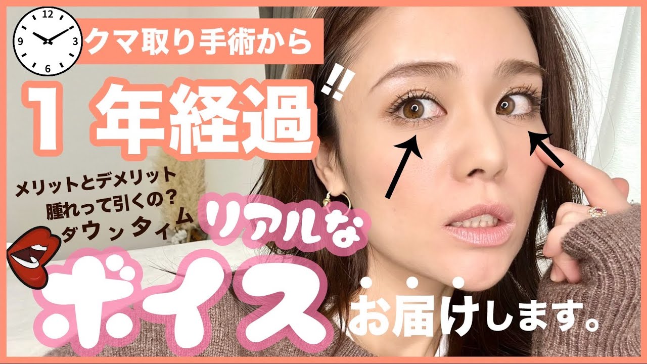 目の下のきらないたるみとり！1年経過しましたー