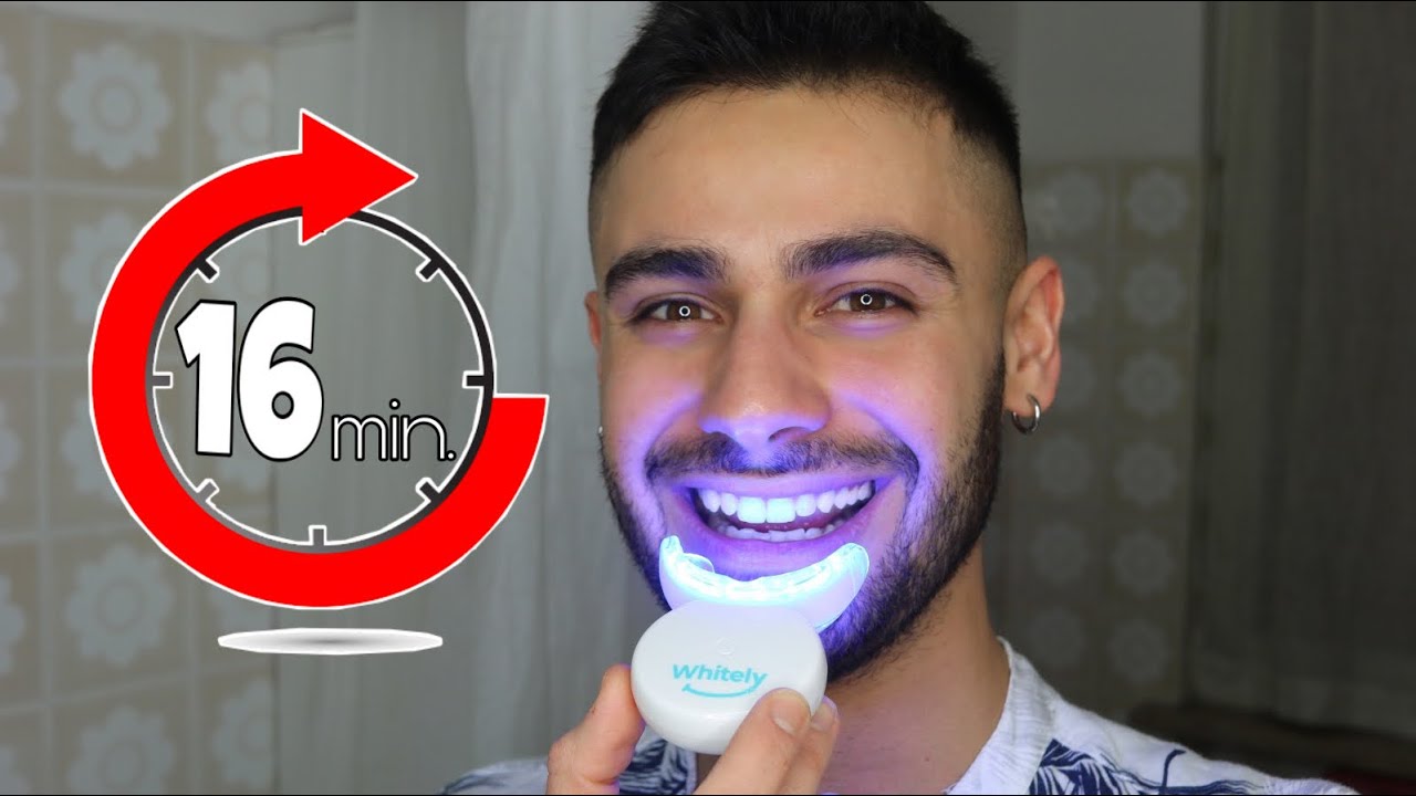 Denti Bianchi In Soli 16 Minuti Vinklob Youtube