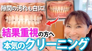 【必見】これが歯の隅々まで白くなるクリーニング！キレイになりたい人にオススメ！