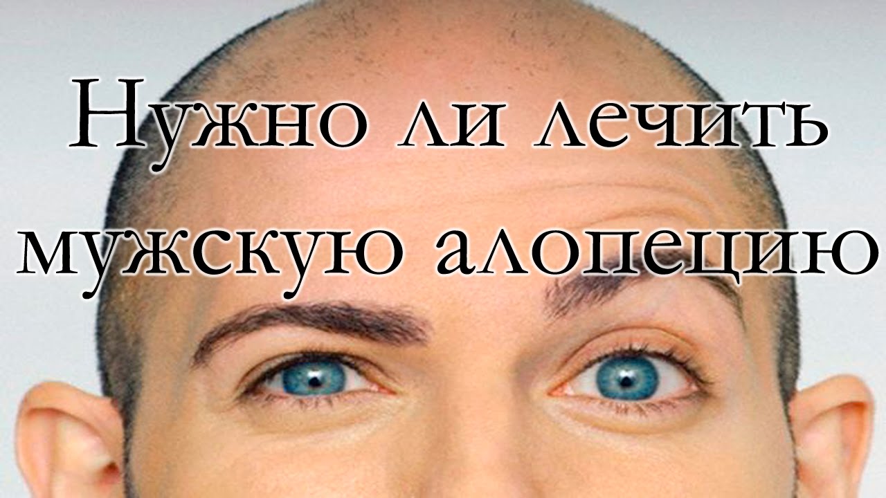 Нужно ли лечить мужскую алопецию - YouTube