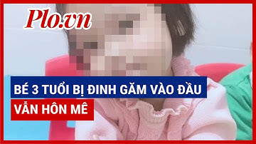 Hà Nội: Bé gái 3 tuổi bị đinh găm vào đầu vẫn hôn mê sau 1 tháng điều trị - PLO