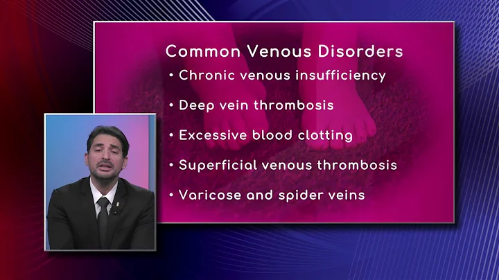 Common Venous Disorders