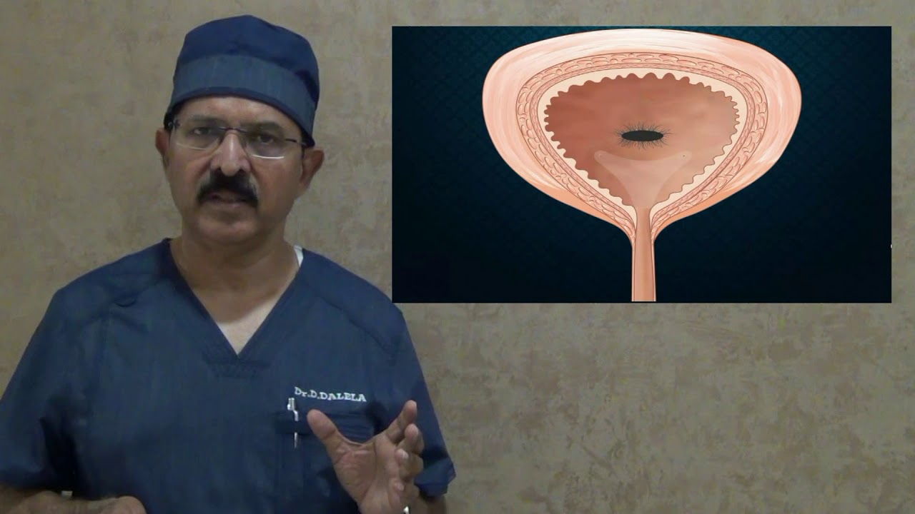 video phone beyonce mp3 What defends urinary bladder from bacterial attack