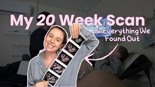My 20 Week Scan & Everything We Found Out 💕