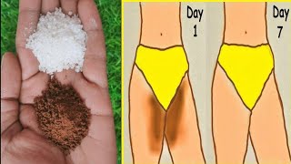 Result In Just 10 minutes Dark Underarm and private parts Whitening 100% Works