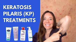 Dermatologist Tips for Treating Keratosis Pilaris
