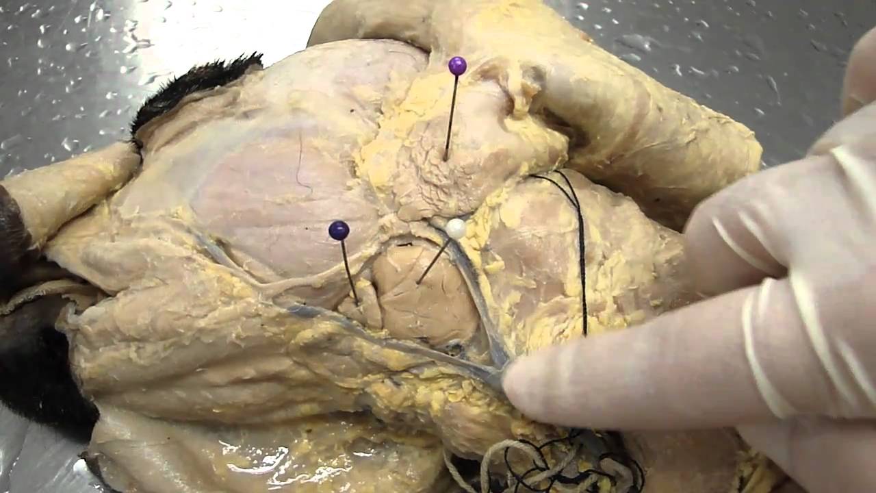 Cirurgia Cervical e das Glândulas Salivares