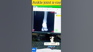 ⚕️Ankle joint x-ray😈#xray #radiology #xraytech #radtech #radiologist #mri #radiologia #xrays