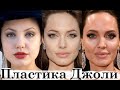 Неидеальная Анджелина Джоли - Пластика и косметология (2021)