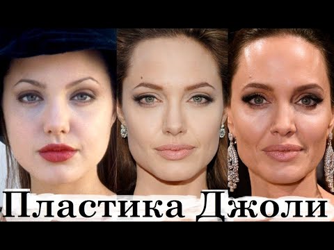 Бейне: Анджелина Джоли жаңа операцияға дайын